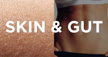 Psoriasis – A Gut Related Disorder