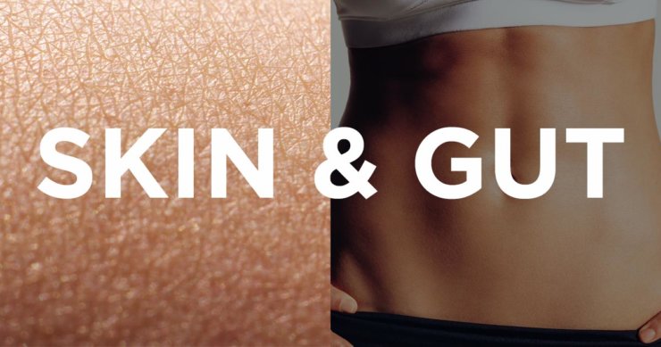 Psoriasis – A Gut Related Disorder